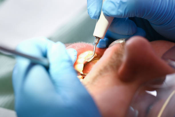 Best Emergency Treatment for Dental Infections or Abscesses in Nd Point, WI