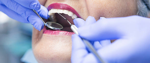 Best Urgent Care for Lost Fillings or Crowns in Nd Point, WI